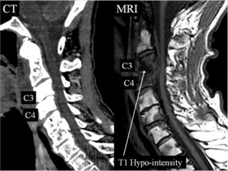 Chi phí chụp MRI bao nhiêu tiền ? Chụp ở đâu uy tín ?