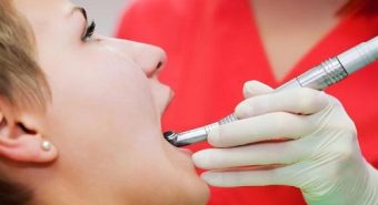 Có cần thiết phải khám răng miệng trước khi phẫu thuật ung thư lưỡi?