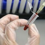 Đột phá mới trong chẩn đoán sớm bệnh ung thư xương