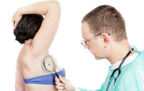 Phân tử mới chữa trị ung thư da mở ra hy vọng cho các bệnh nhân