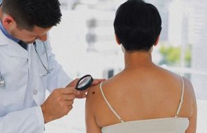 Các bác sĩ sẽ dựa vào tình trạng bệnh của bệnh nhân để đưa ra phương pháp điều trị ung thư da thích hợp.