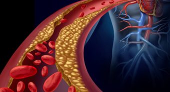 Báo động máu nhiễm mỡ ngày càng trẻ hóa