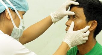 Diễn biến nguy hiểm của bệnh xơ gan bạn cần biết