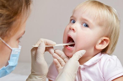 Không nên thực hiện cắt amidan cho trẻ dưới 5 tuổi