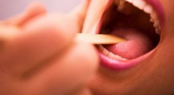 Cách điều trị viêm amidan theo từng dạng