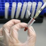 Nghiên cứu mới giúp chẩn đoán xơ gan chính xác nhờ xét nghiệm máu