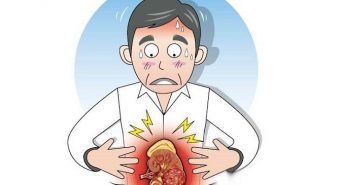 Đau bụng, tiểu ra máu là triệu chứng ung thư thận