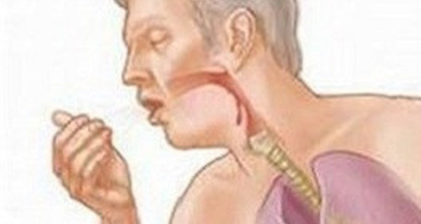 Dấu hiệu nhận biết khi bị trào ngược dạ dày