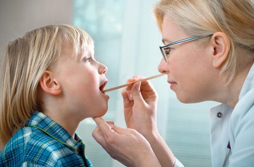 Giải đáp thắc mắc viêm họng hạt có lây không để phòng tránh