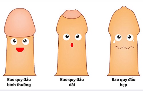 Nguyên nhân dẫn đến ung thư dương vật