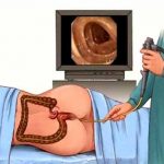 Cách phát hiện và loại bỏ ung thư đại trực tràng từ 