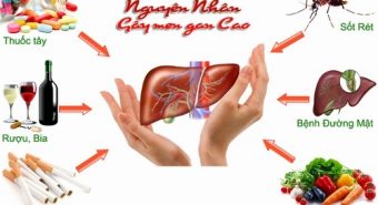 Men gan cao có biến chứng thành bệnh ung thư gan hay không?