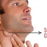 Những biểu hiện ung thư miệng nhiều người thường bỏ qua