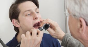 Nổi hạch ở cổ có phải là dấu hiệu nhận biết ung thư amidan
