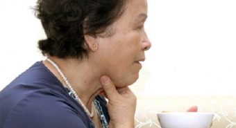 Nuốt nghẹn có thể là dấu hiệu của ung thư thực quản