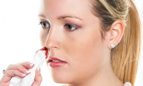 Phân biệt sự khác nhau giữa viêm họng hạt và ung thư vòm họng