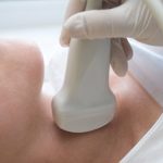 Phương pháp điều trị ung thư tuyến giáp bằng I-131