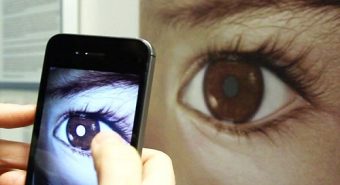Sử dụng smartphone để phát hiện ung thư mắt