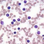 Tình cờ phát hiện loại protein tiêu diệt tế bào ung thư