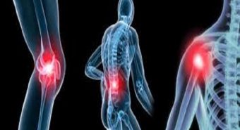 Triệu chứng của bệnh đa u tủy xương và những biến chứng nguy hiểm