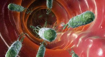 Vi khuẩn Helicobacter Pylori gây bệnh đau dạ dày
