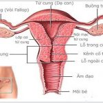 Viêm lộ tuyến cổ tử cung cản trở phụ nữ được làm mẹ