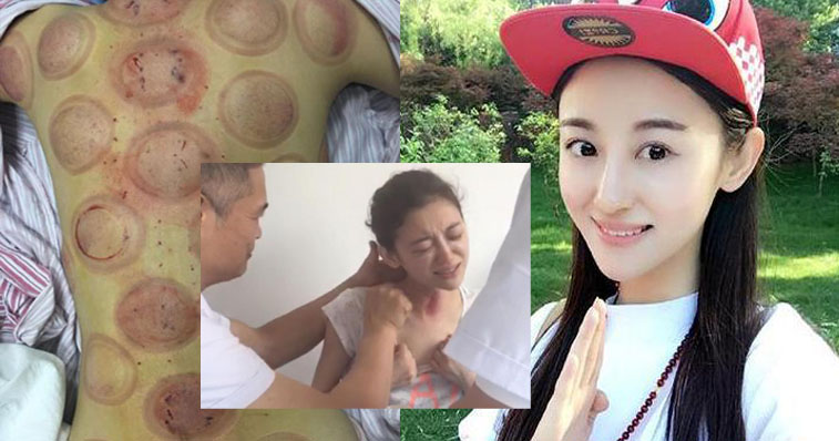 Diễn viên xinh đẹp từ giã cõi đời ở tuổi 26 vì ung thư hạch