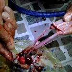 Thiếu hiểu biết về điều trị ung thư, nạn nhân tử vong do ăn thịt cóc