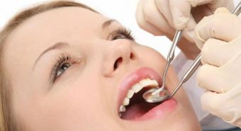 Nguy cơ ung thư miệng do sức khoẻ răng miệng kém