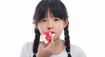 Phát hiện ung thư máu sớm bằng những dấu hiệu đơn giản