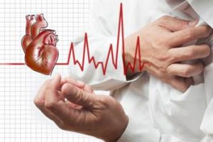Tai biến mạch máu não