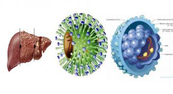 Tìm hiểu nguyên nhân gây bệnh viêm gan B