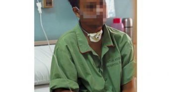 Chàng trai bị ung thư miệng ở tuổi 24 do hút thuốc quá nhiều