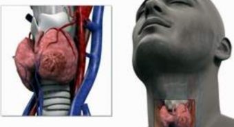 Điều trị ung thư thanh quản bằng những cách nào?