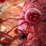 Bí quyết của người phụ nữ hơn 20 năm sống chung với ung thư di căn