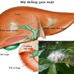 Lá xạ đen chữa ung thư như thế nào? Cách dùng xạ đen trị ung thư